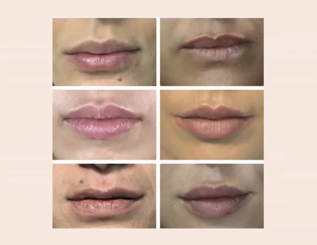 Collage de gros plans photographiques sur des lèvres et le bas du visage.